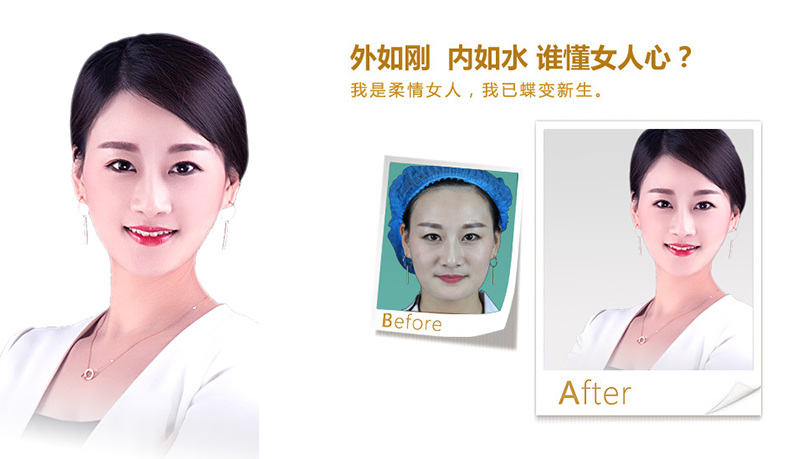 淄博V脸、线雕隆鼻